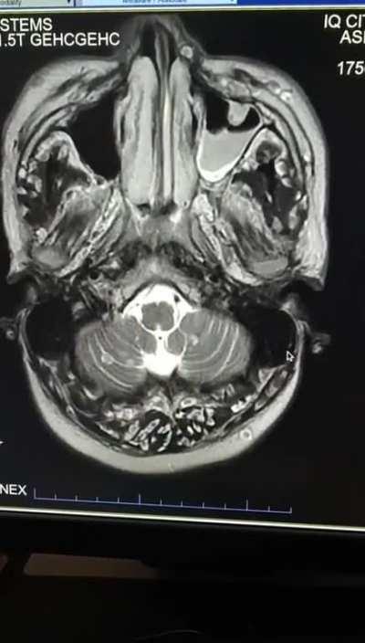 Parasites and Cysts #0003