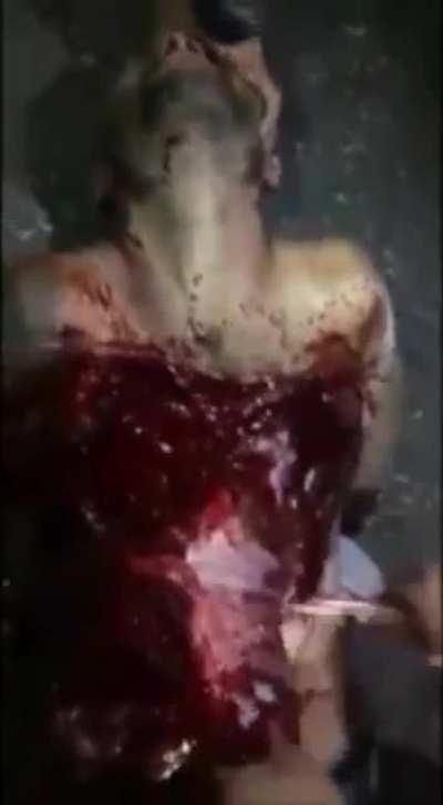 Cutting through chest