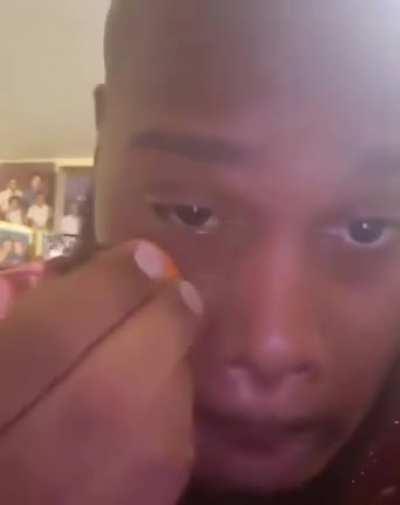 Man uses secret ingredient to prevent eye bags