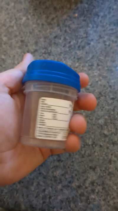 Soda saver fits a urine sample cup.