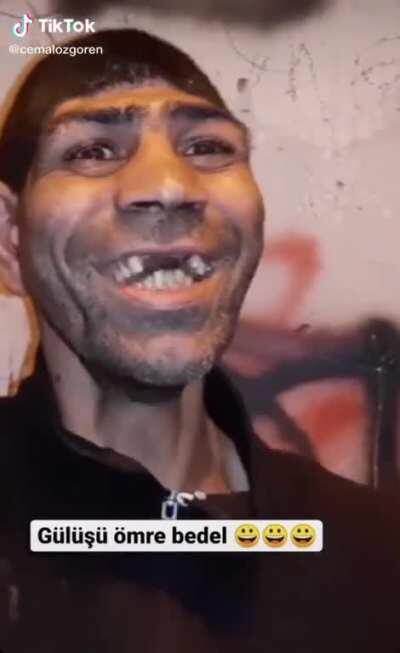 Illojuan pinchandose en vena en perú