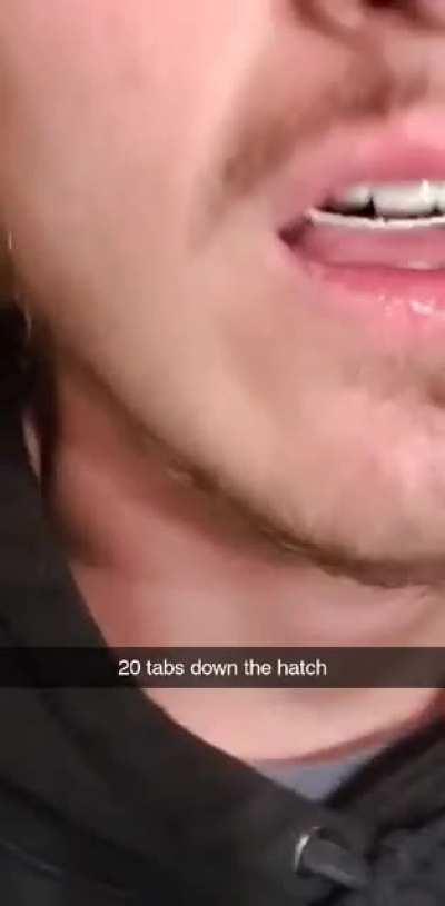 The before hand of my 