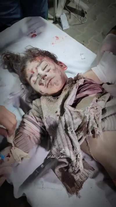 The result of Israel’s targeted attack on Hamas