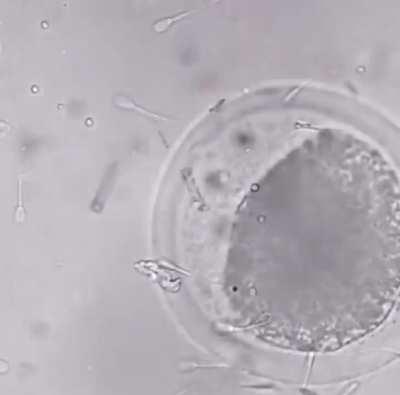 Nanobot assists one sperm to reach the egg