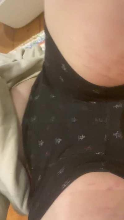 I think my dick is on the wrong way round?