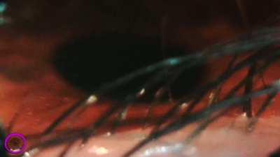 You're so close, shouting up from my eyelashes, but still too small to be seen