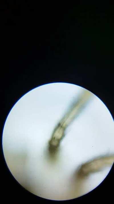 Spider!, you can see the hemolymph (spider blood) flowing inside it's legs