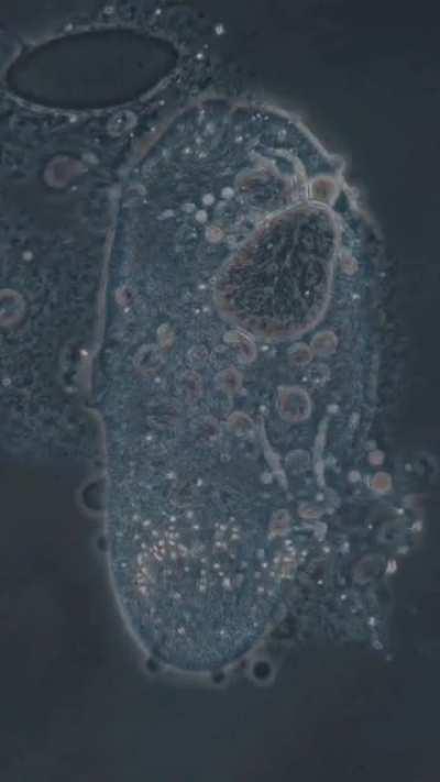 A Unicellular Organism Dying