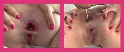 Attention Buttfuckers! Let’s take a poll: What do you prefer, Cumfarts or Gapeshots?