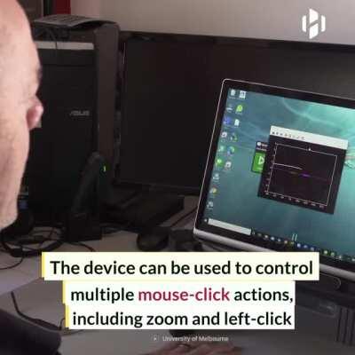 Endovascular Stentrode BCI, a brain implant that allows people with paralysis to control computers using their thoughts