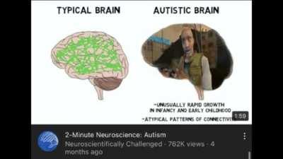 brain named autistic: