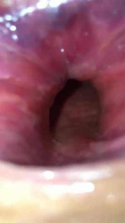 Take a look deep inside