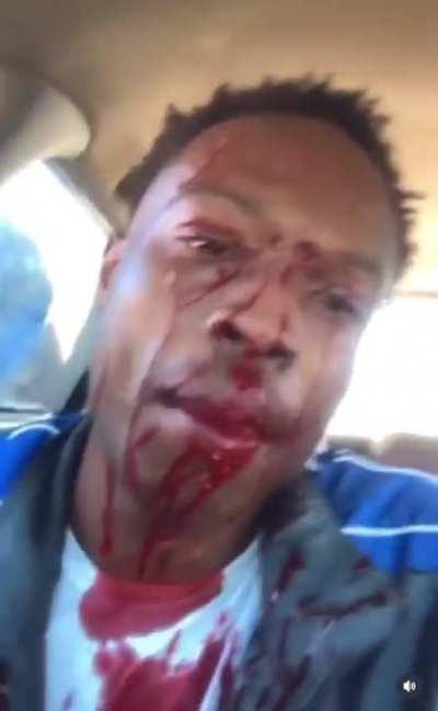 Guy gets shot in the face and records it.