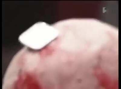 Context unknown, professional wrestler gets cpu smashed into head