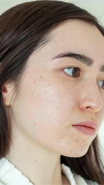 What skin actually looks like