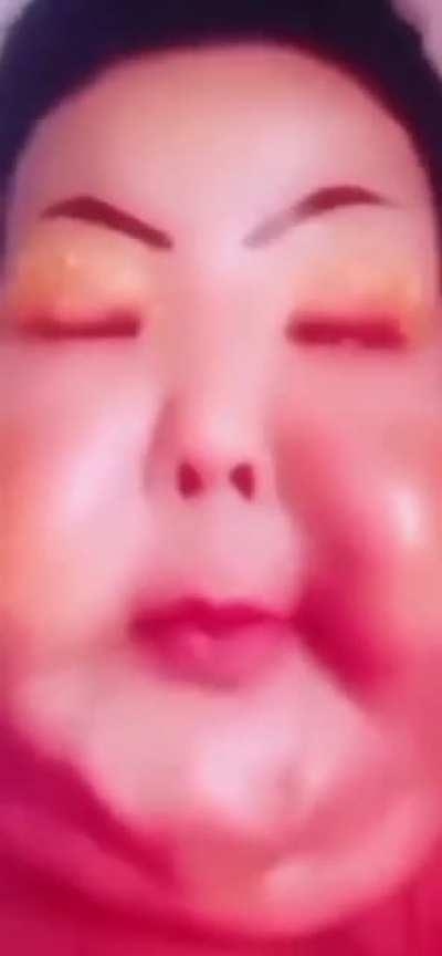 Juju of Pix (injected industrial silicone in her face)