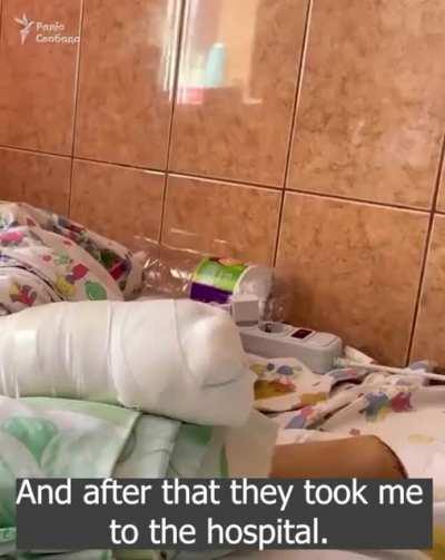 Mother and child lost their legs in the russian missile strike