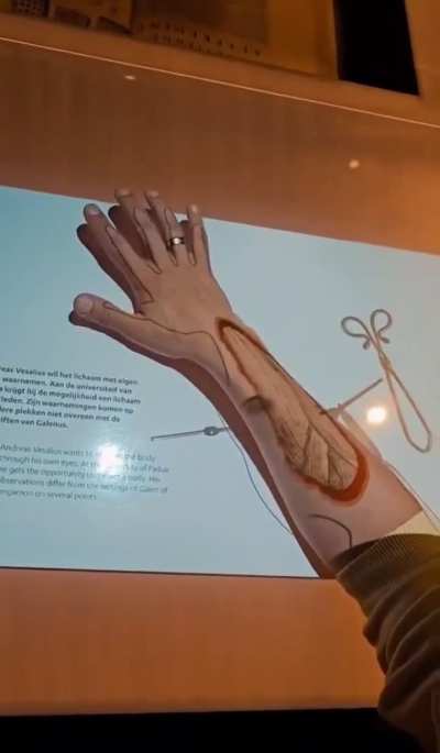 This is a pretty cool device to show off your anatomy