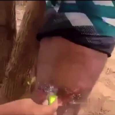 Home Remedies on Wound