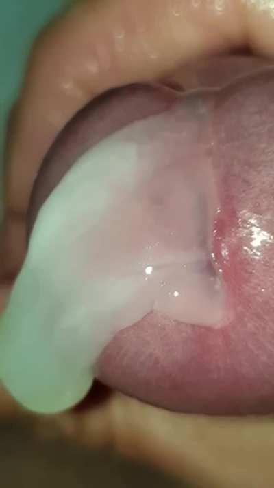 Anyone know how to stop this leak