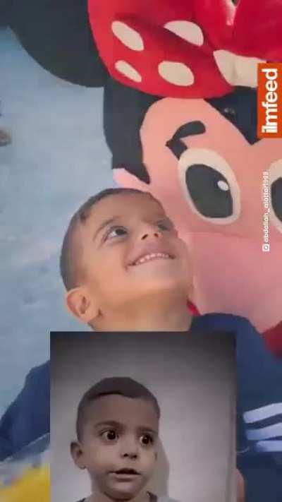 Guys remember this boy from Gaza? Allhumdulilah he is fine now.