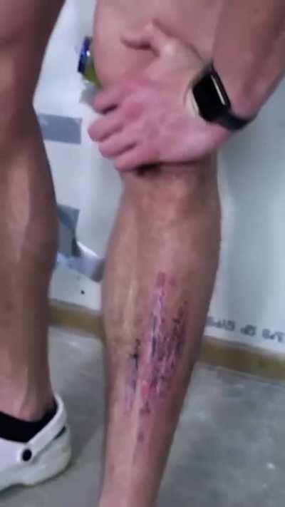 Pouring salt on a wound