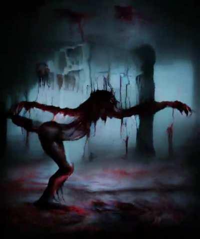 Dead Ballet Dancer (With Audio)