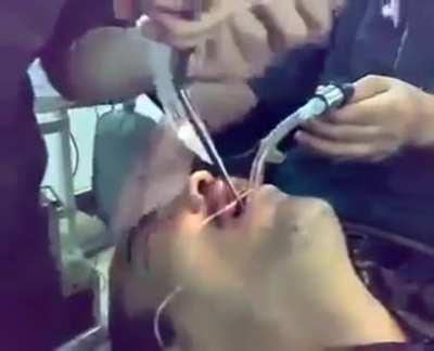 HMFT after I try to swallow a fucking wrench