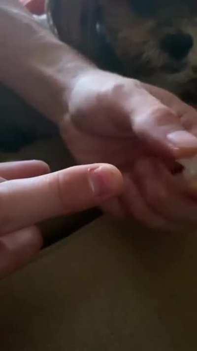 One of three fingernails lost after a mountain bike accident