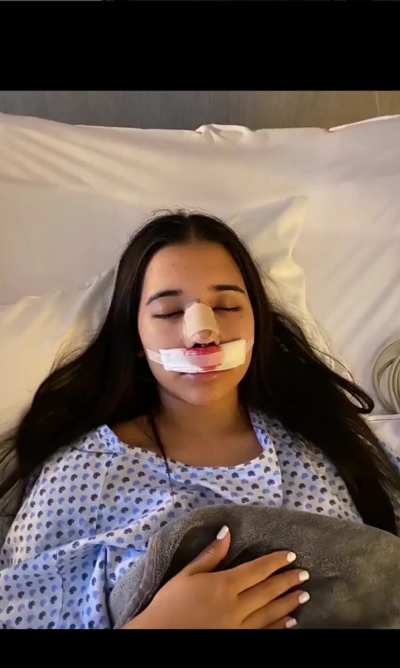 Don't get surgery, you already look beautiful