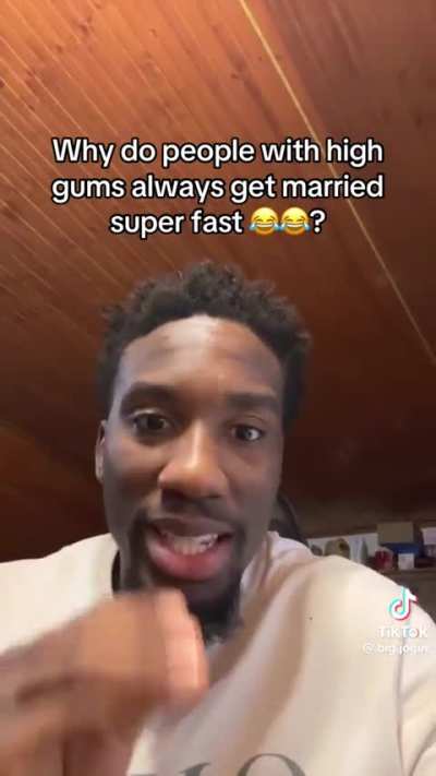 Why Do People With Gummy Smiles Always Get Married Super Fast!??