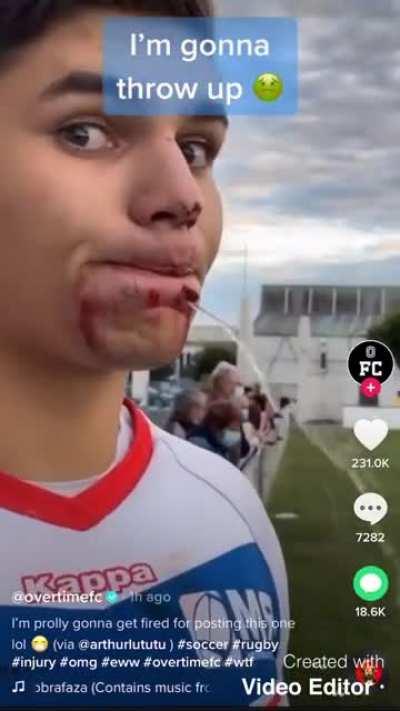 I’m gonna throw up 🤢