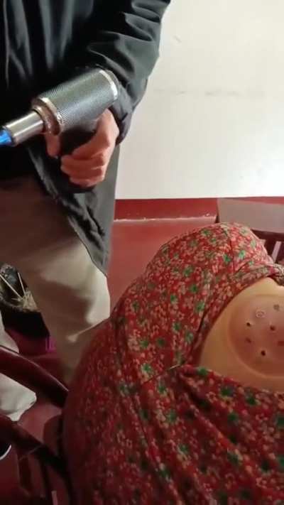 Insane Warm-Needling Acupuncture