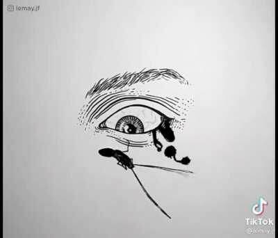 Why are your eyes so itchy?