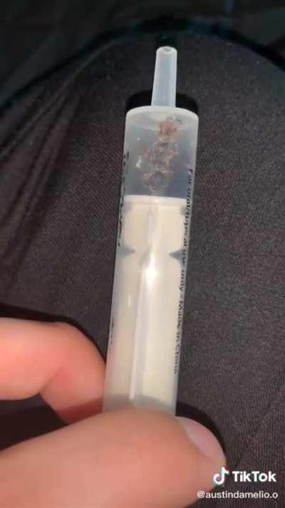 the most r/fuckwasps thing i’ve ever seen