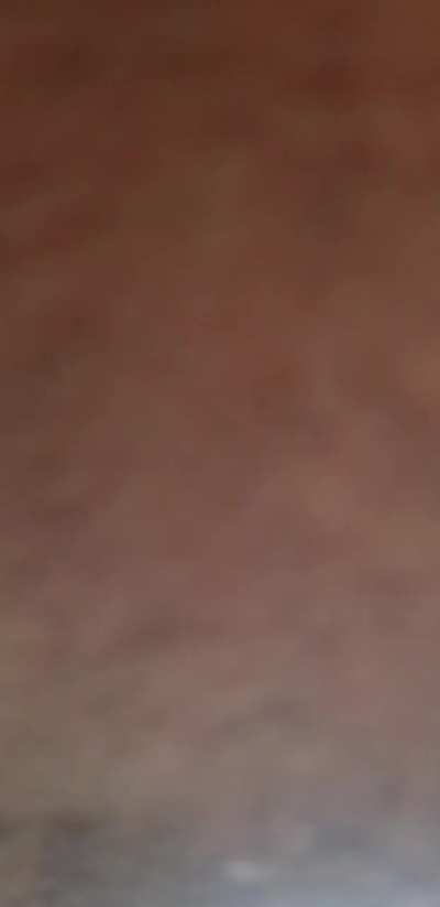 I was assaulted by Tony Sopranos busted cousin Prince Rogaine.... be careful out there he's still on the loose...