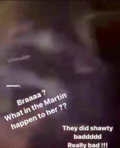 Girl after getting beaten by other women for talking shit on Facebook