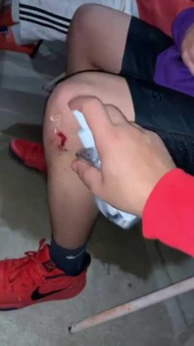 Need to clean the wound man..