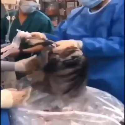 In this video, we are looking at the blackened lungs of a 52-year-old man who smoked about 1 pack a day for ~ 30 years. The patient had signed up to donate his organs after death, but doctors quickly realized that they would not be able to use them. We ca