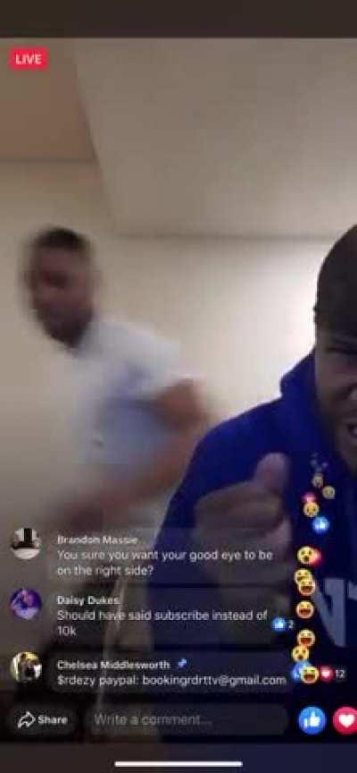 Man lights firecracker in his eye