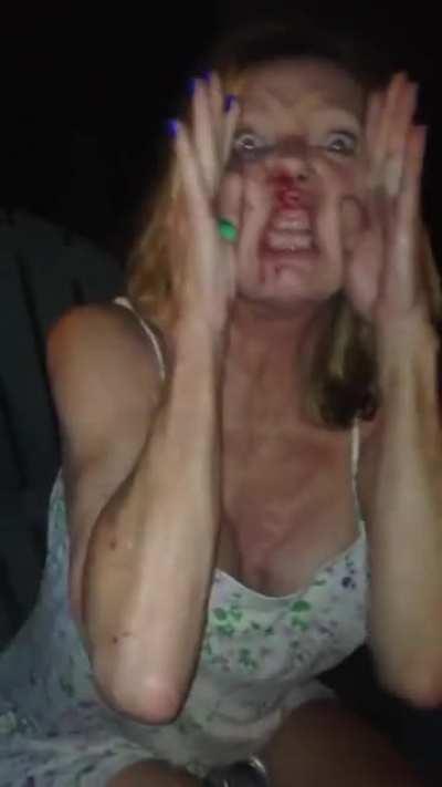 Methany gives post fight interview