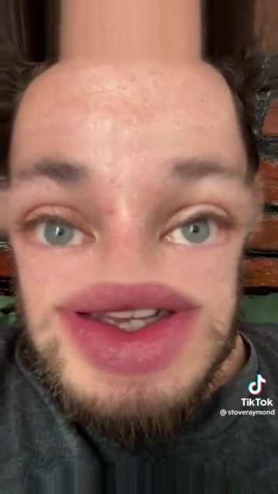 Kind of a shitpost but it was fixed by the duet!!