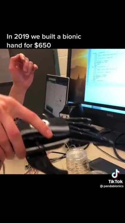 Groundbreaking prosthetic tech all by 1 person…