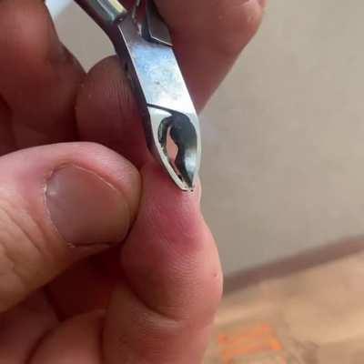 I had a splinter break off in my finger 3 weeks ago. It was so deep, no amount of digging could reach it. Today, it finally showed itself