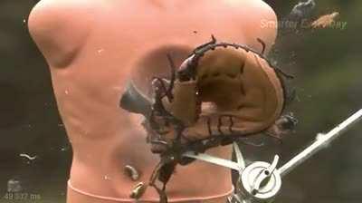 What a baseball traveling at 1000 mph does to you