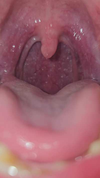 {M} My mouth looks so inviting doesn't it?