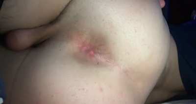 would you stretch my hole?