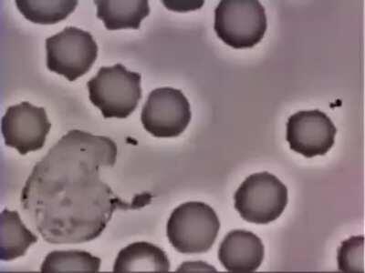 We never see wbc in action, mostly “still” slides.