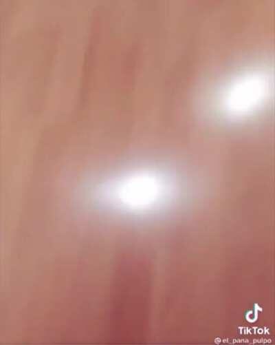 La puta madre se escapó la basura otra vez