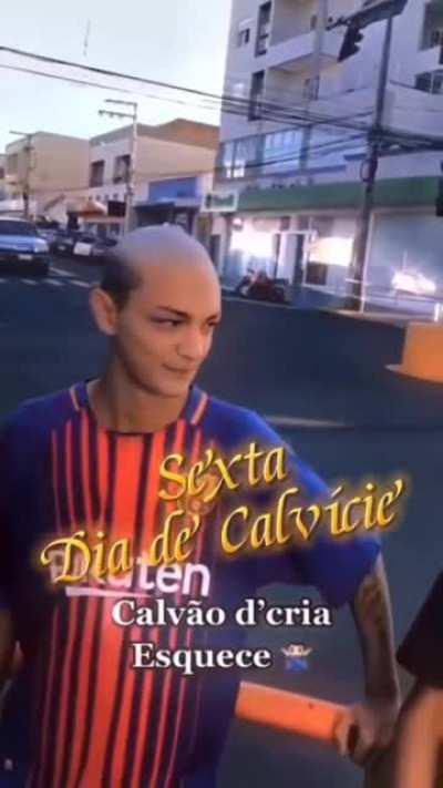 Ser calvo tá no hype